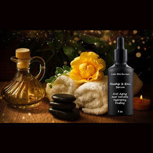 Rosehip & Emu Serum Can Help With Skin Issues 1 oz bottles Scented or Non Scented